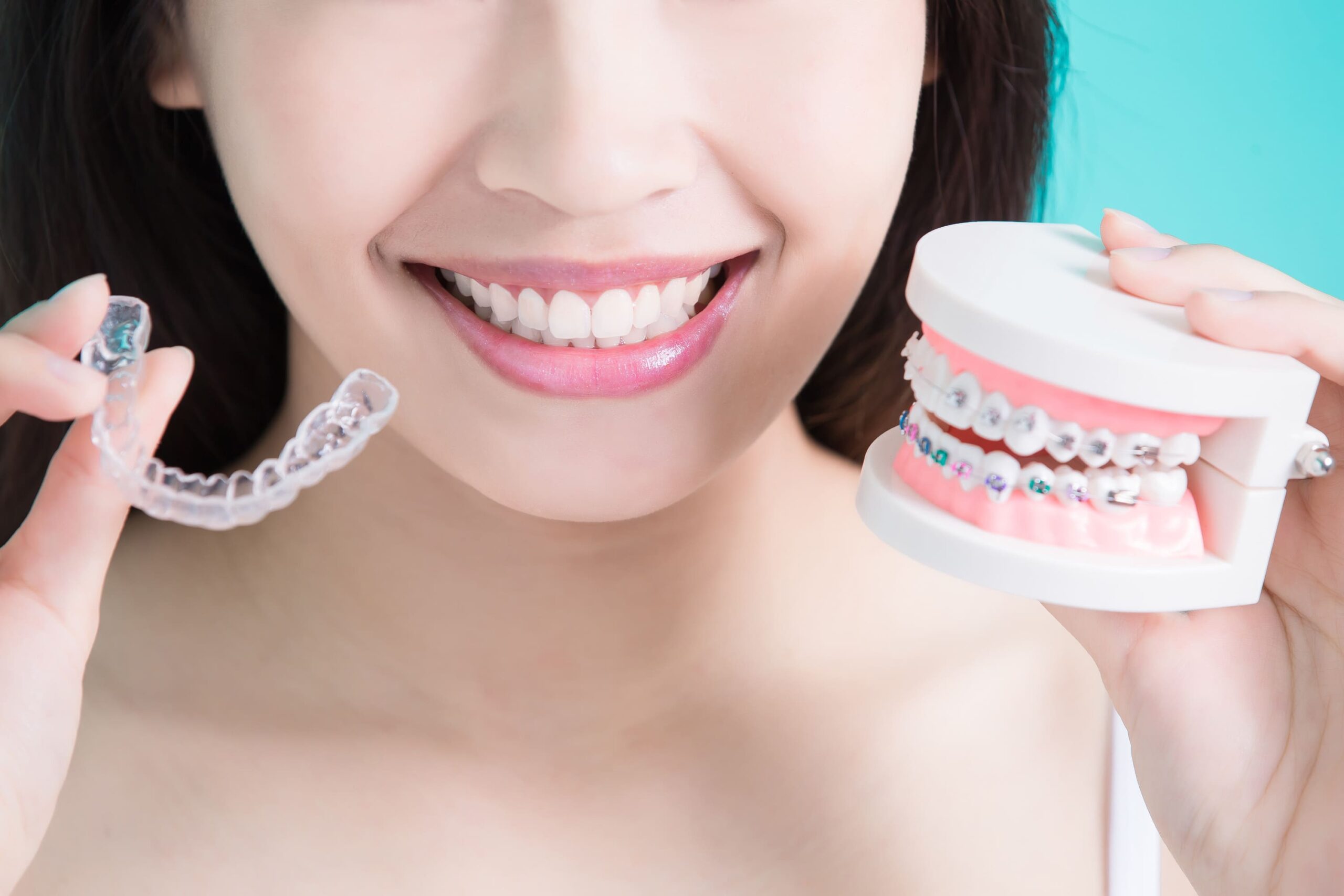 Dental implants in sivananda colony